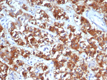 IL18R1 Antibody