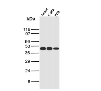 SMARCB1 Antibody