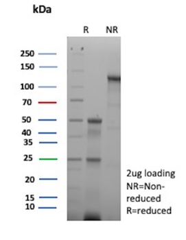 SMARCB1 Antibody