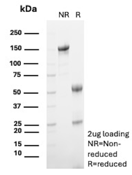 CCL23 Antibody