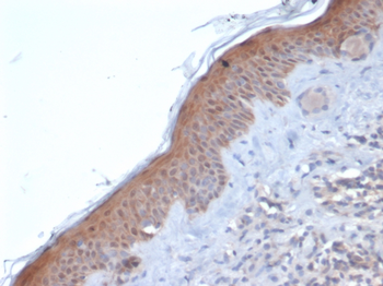 SERPINB5 Antibody
