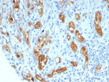 SERPINB5 Antibody