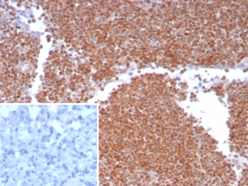 MGMT Antibody