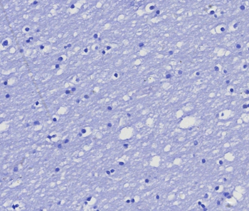 MGMT Antibody