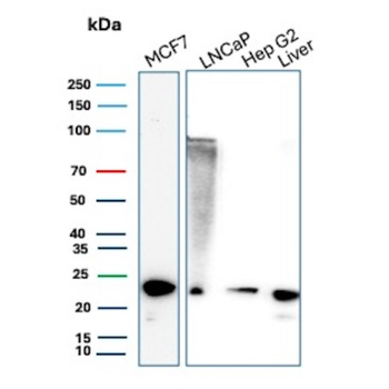 MGMT Antibody