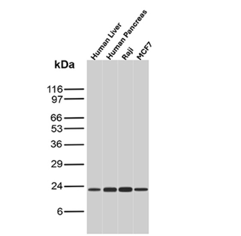 MGMT Antibody