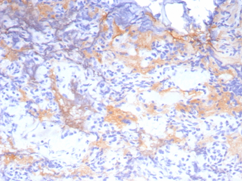 GH1 Antibody