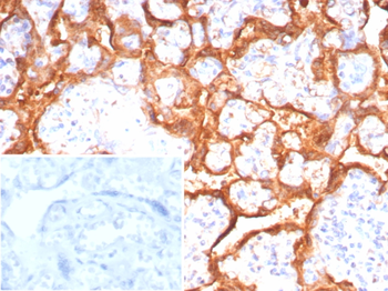 GH1 Antibody