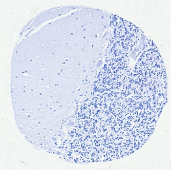 IRF4 Antibody
