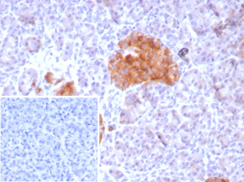 GAD2 Antibody