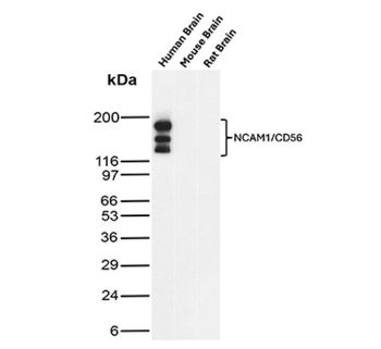 NCAM1 Antibody