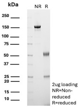 NCAM1 Antibody