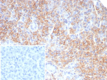 CD99 Antibody