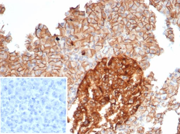 CD99 Antibody