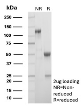 CALCA Antibody