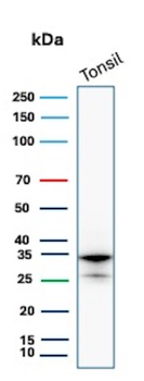 MS4A1 Antibody