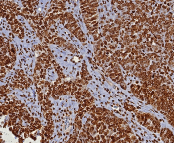 Recombinant Double Stranded DNA (dsDNA) (Nuclear Marker) Antibody