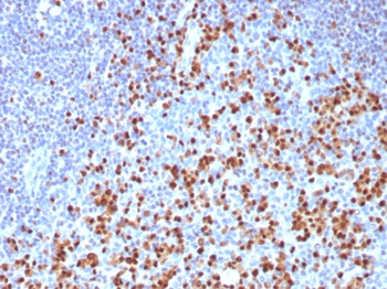 IRF4 Antibody