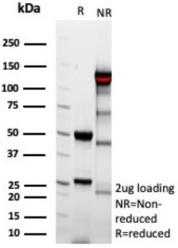 Recombinant Complement 4d (C4d) (Acute Humoral Rejection Marker) Antibody