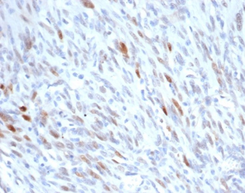 MDM2 Antibody