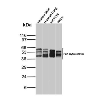 KRT77 Antibody