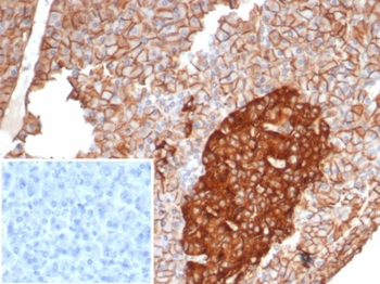 CD99 Antibody