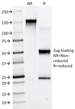 IgG1 Isotype Control for Mouse Antibody