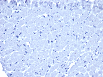 IgG1 Isotype Control for Mouse Antibody