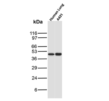 KRT77 Antibody