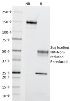 CCR5 Antibody