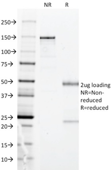 HLA-DPB1 Antibody