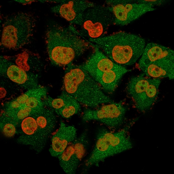 UCHL1 Antibody
