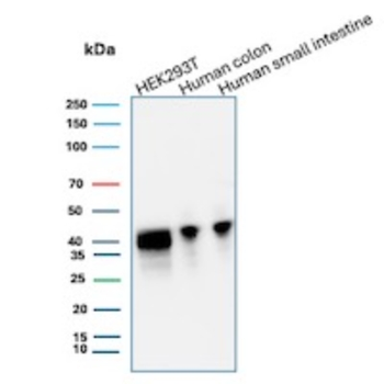 CDX2 Antibody