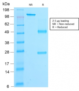 CTNNB1 Antibody