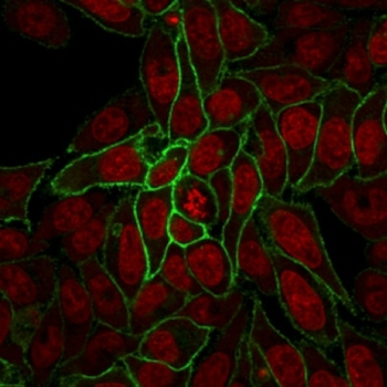 CTNNB1 Antibody