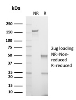 CTNNB1 Antibody