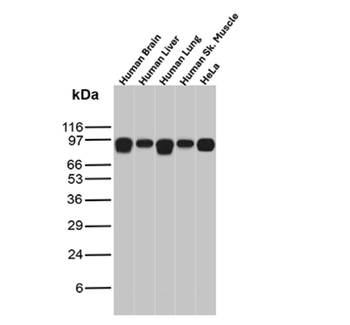 CTNNB1 Antibody