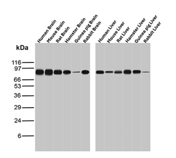 CTNNB1 Antibody