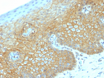 CTNNB1 Antibody