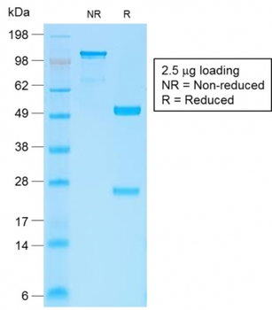 CTNNB1 Antibody