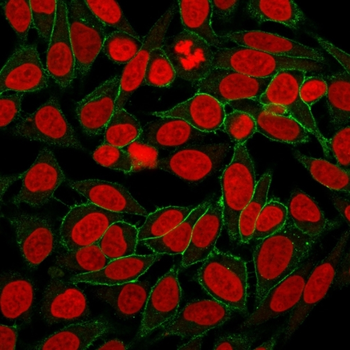 CTNNB1 Antibody