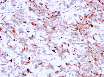 CTSK Antibody