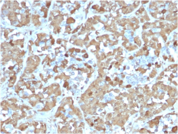 GH1 Antibody