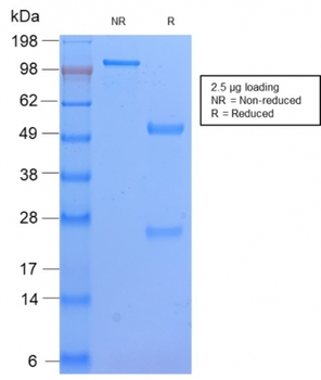 HLA-DPB1 Antibody