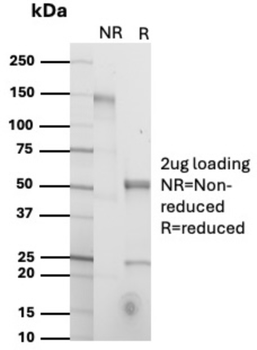HLA-DQA1 Antibody