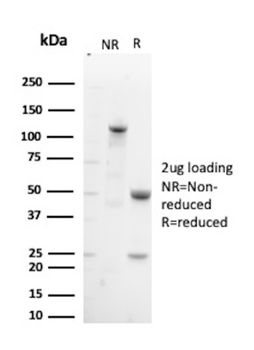 HLA-DQA1 Antibody