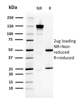 HSPB1 Antibody
