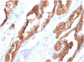 HSPB1 Antibody