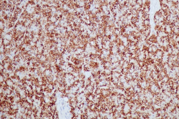 HSPD1 Antibody