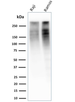 MKI67 Antibody